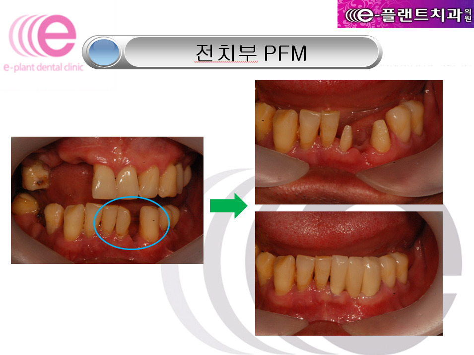 e-플랜트치과 이미지