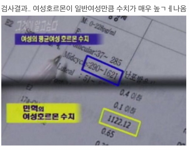 민혁이의 성전환수술 스토리 (그것이 알고싶다) | 인스티즈