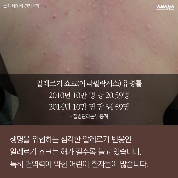 염색약 바르는데 피부가 부어오른 이유 | 인스티즈